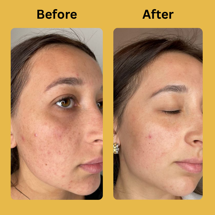 Medicube Kojic Acid Turmeric Night Wrapping Mask