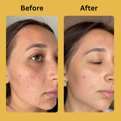 Medicube Kojic Acid Turmeric Night Wrapping Mask
