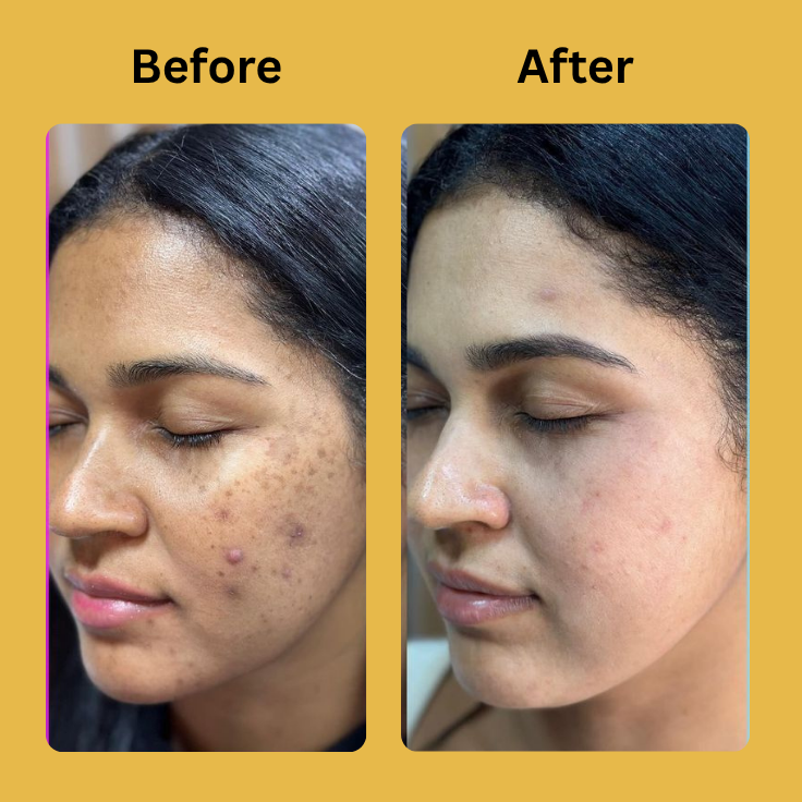 Medicube Kojic Acid Turmeric Night Wrapping Mask