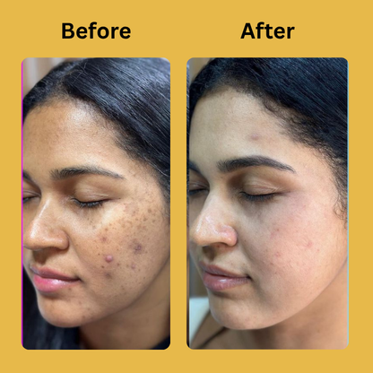 Medicube Kojic Acid Turmeric Night Wrapping Mask
