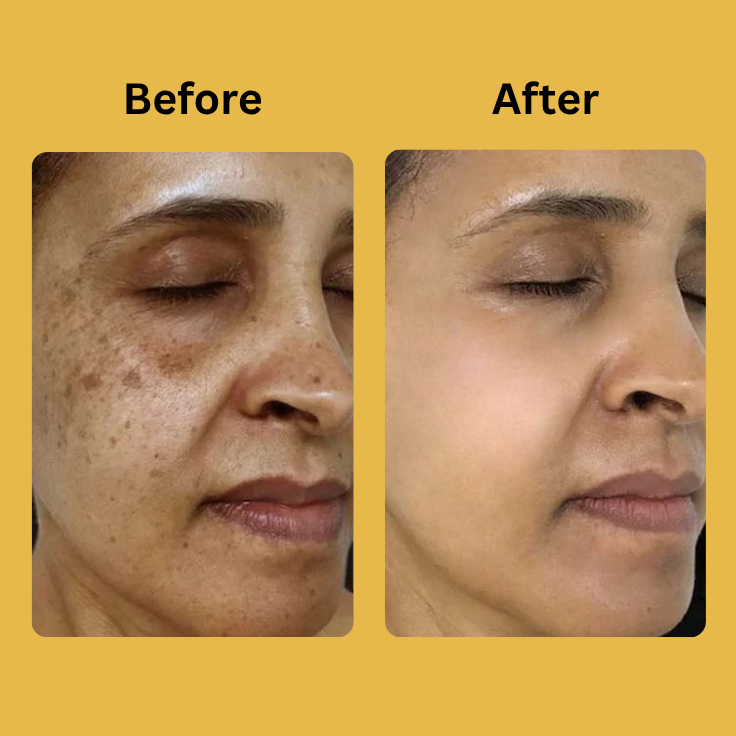 Medicube Kojic Acid Turmeric Night Wrapping Mask