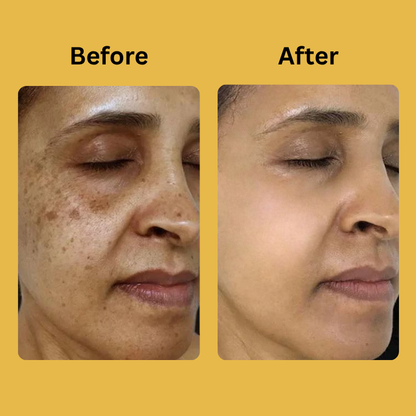 Medicube Kojic Acid Turmeric Night Wrapping Mask