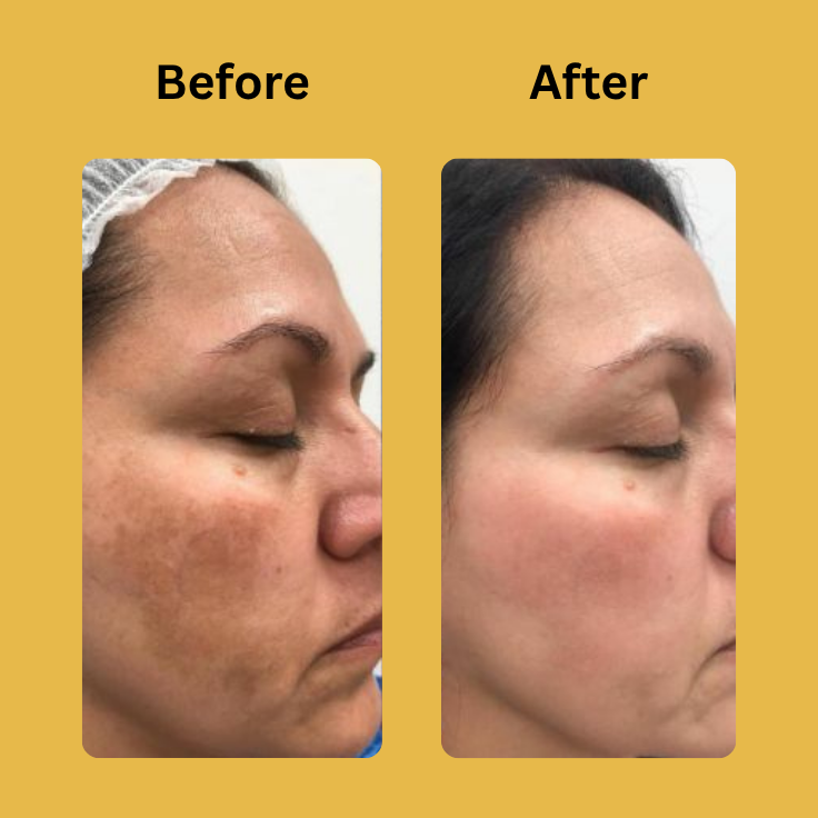 Medicube Kojic Acid Turmeric Night Wrapping Mask