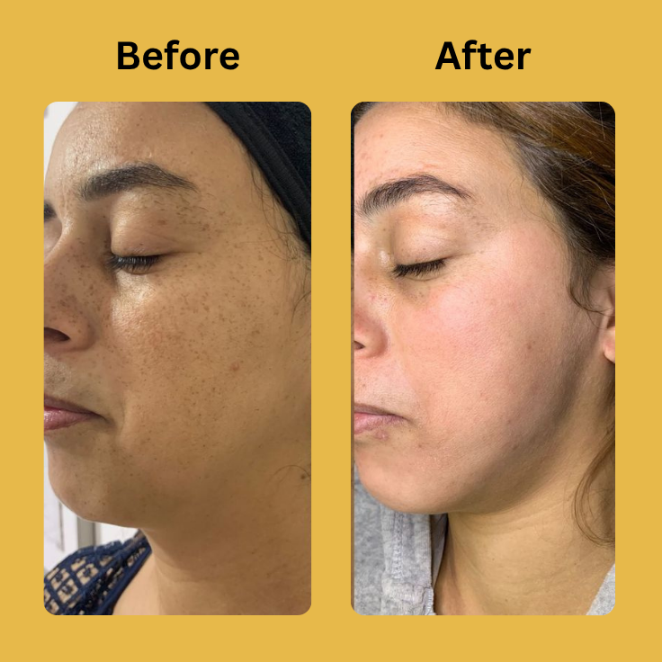 Medicube Kojic Acid Turmeric Night Wrapping Mask