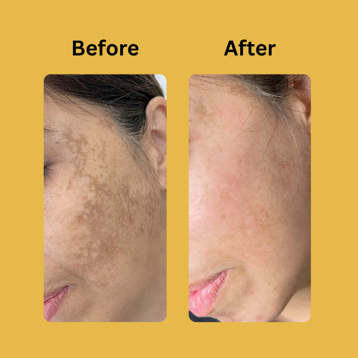 Medicube Kojic Acid Turmeric Night Wrapping Mask