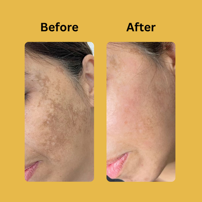 Medicube Kojic Acid Turmeric Night Wrapping Mask