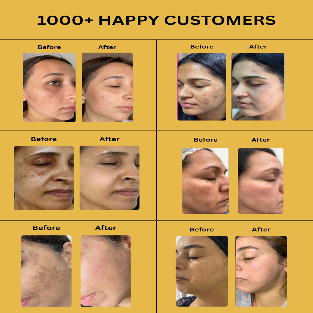 Medicube Kojic Acid Turmeric Night Wrapping Mask